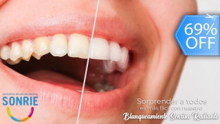 [Image: ¡Nuevo Blanqueamiento Sonrisa Radiante!  Aclara hasta 2 Tonos, Terapia Desensibilizante y Más.m]