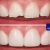 [Image: ¡Paga $40 en Lugar de $230 por Reconstrucción Estética Mínimamente Invasiva con Resina de 4 Dientes Frontales + Consulta General + Revisión de Cordales + Limpieza Dental + Aplicación Tópica de Flúor!m]