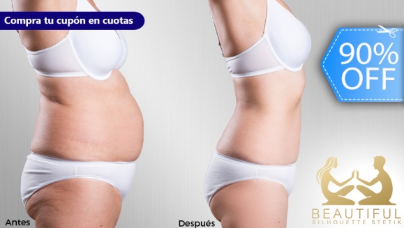 [Image: ¡Nueva Figura en 4 Semanas! ¡Paga Q399 en Lugar de Q4,199 por un Pack de 150 Tratamientos Reductores Intensivos y con Acción Anti-Obesidad Localizada para Cuerpo Completo!m]