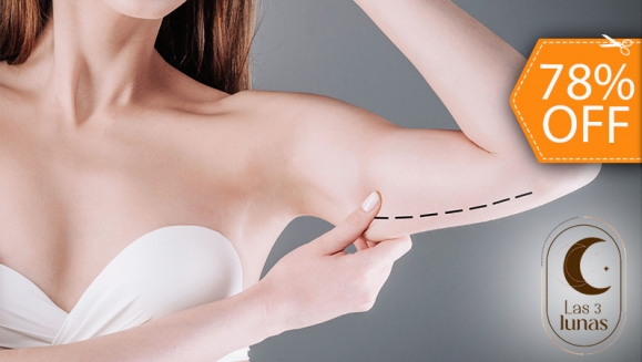 [Image: ¡Paga $28 en Lugar de $125 por 18 Tratamientos para Reducción de Brazos: 3 Criolipólisis + 3 Lipoláser + 3 Mesoterapias Virtuales + 3 Tonificadores Musculares + 6 Lipogeles + Evaluación Estética + Toma de Medidas y Peso + Menú Detox!m]