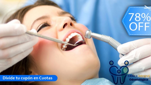 [Image: ¡Paga Q325 en Lugar de Q1,500 por 3 Rellenos o 4 Sellantes + Limpieza Profunda con Ultrasonido + Pulido Dental con Profijet + Aplicación de Flúor + Examen Dental y Evaluación con Cámara Intraoral!m]