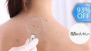 [Imagen:¡Paga Q75 en Lugar de Q1,100 por Cauterización Láser de Hasta 20 Cabezas de Vena, 4 Lunares o 4 Verrugas (de hasta 5 mm) + Evaluación Médica!]